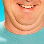 이중턱살 빼는법