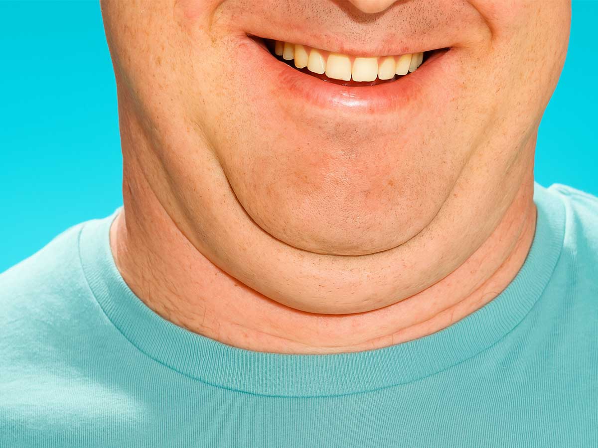 이중턱살 빼는법